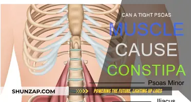 Tight Psoas Muscle: Constipation Culprit or Coincidence?