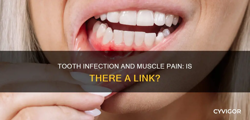 Tooth Infection And Muscle Pain: Is There A Link? | CyVigor
