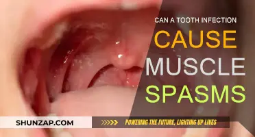 Tooth Infection and Muscle Spasms: Is There a Link?