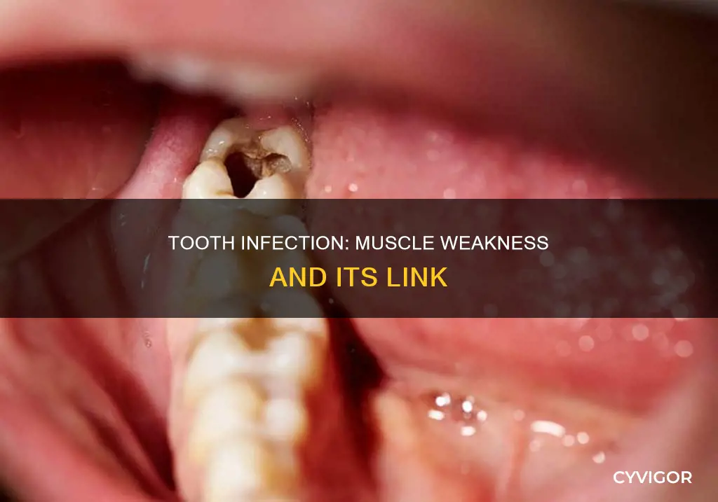 can a tooth infection cause muscle weakness