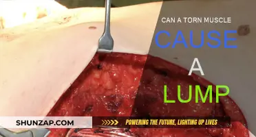 Muscle Tears: Can They Cause Lumps?