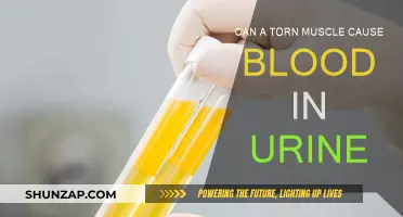 Injured Muscle and Blood in Urine: What's the Link?