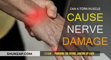 Torn Muscles and Nerve Damage: What's the Link?
