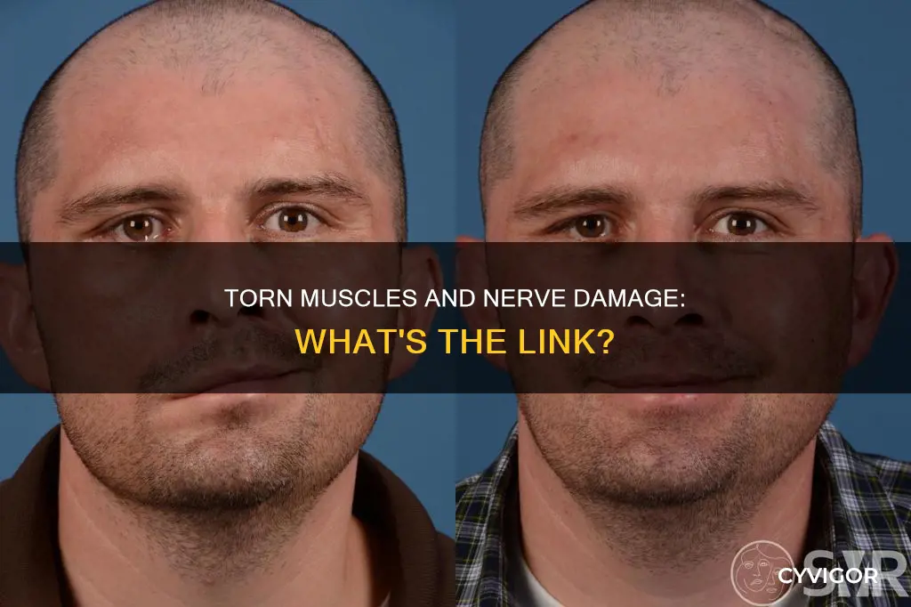 can a torn muscle cause nerve damage
