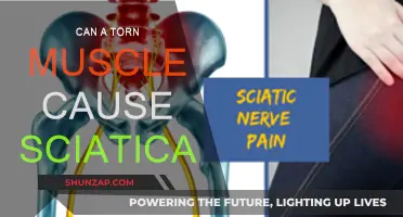 Muscle Tears: A Cause of Sciatica?