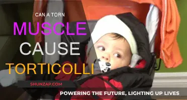 Muscle Tears: A Possible Cause of Torticollis?