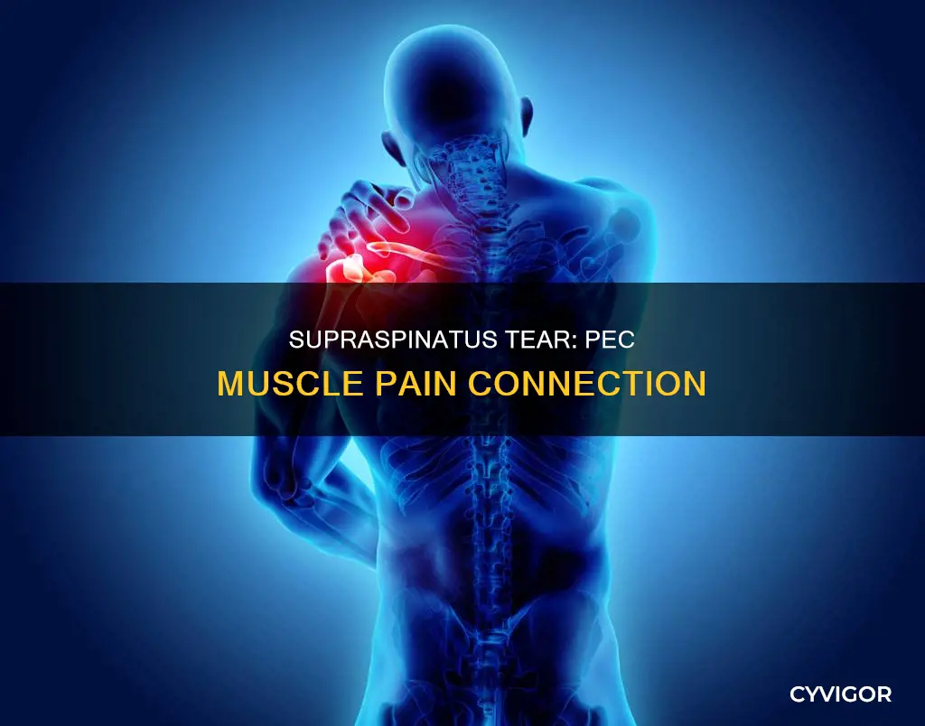 can a torn supraspinatus cause pain in the pectoral muscle