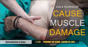 Tourniquets: Saving Lives or Causing Muscle Damage?