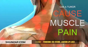 Muscle Pain and Tumors: Is There a Link?