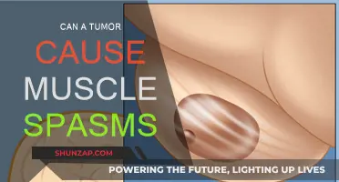 Muscle Spasms: Tumor's Unlikely but Possible Cause
