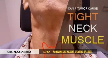 Tight Neck Muscles: Tumor's Unlikely Link