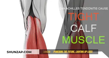 Tight Calf Muscles: Achilles Tendonitis Culprit or Symptom?