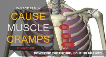 Acid Reflux and Muscle Cramps: Is There a Link?