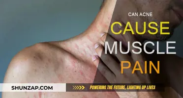Acne and Muscle Pain: Is There a Link?