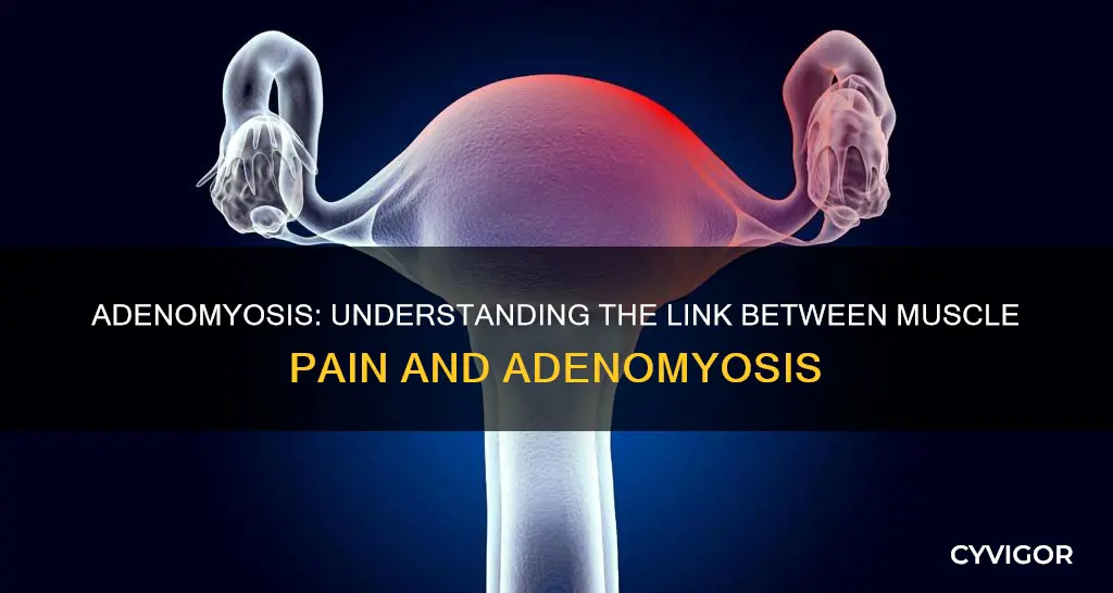 can adenomyosis cause muscle pain