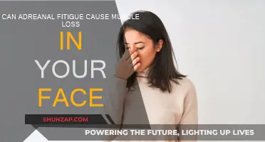 Adrenal Fatigue: Can It Cause Facial Muscle Loss?