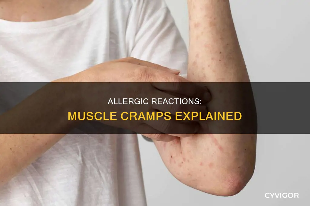 can allergic reaction cause muscle cramps