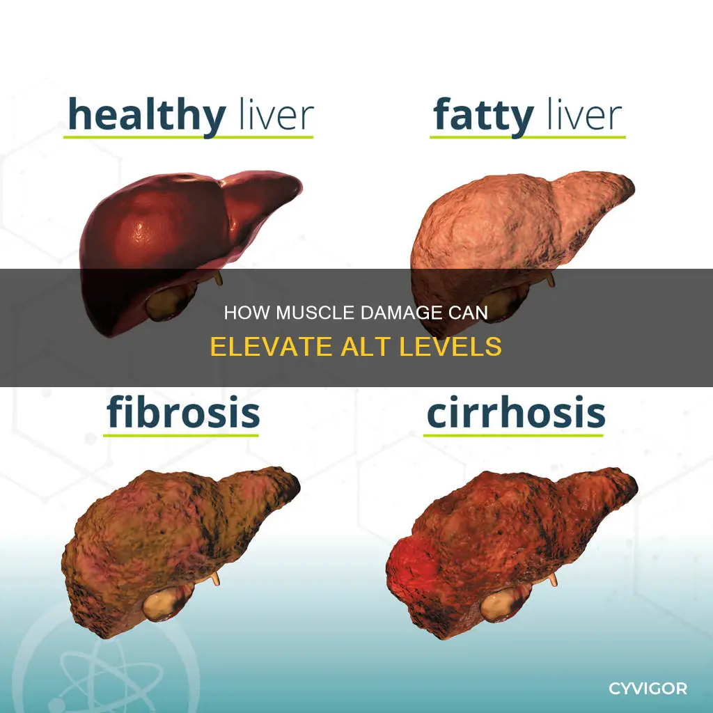can alt elevation be caused by muscle damage
