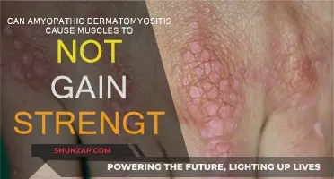 Dermatomyositis and Muscle Strength: What's the Link?