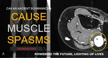 Ancient Schwannoma: Muscle Spasms and Their Causes