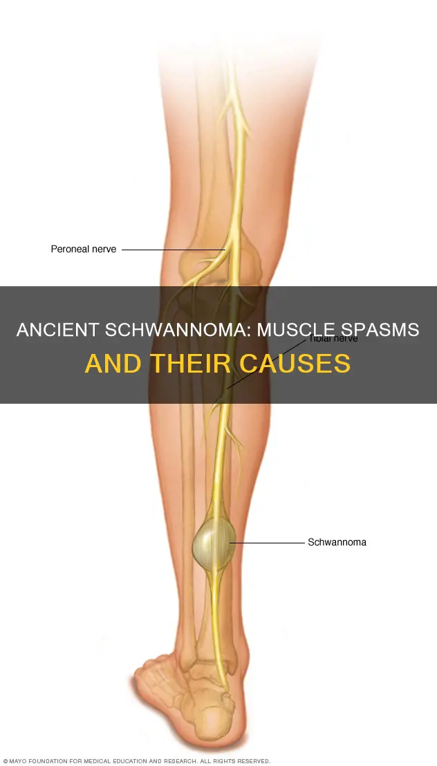 can an ancient schwannoma cause muscle spasms