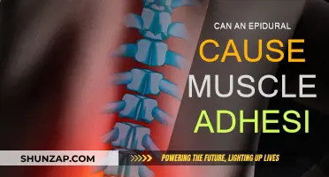 Epidural Adhesions: Uncomfortable Muscle Recovery Side Effect?