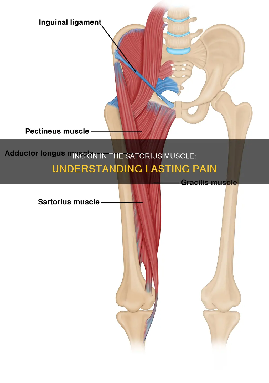 can an incion in the satorius muscle cause lasting pain