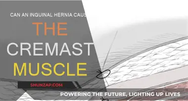Inguinal Hernia and the Cremaster Muscle: What's the Link?