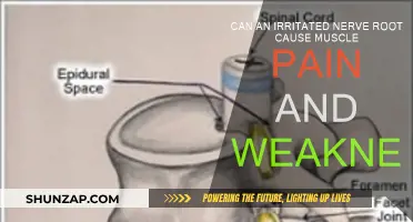 Nerve Pain: Muscle Weakness and Irritation