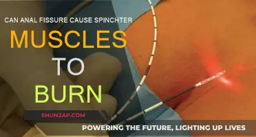 Anal Fissure: Burning Sensation and Spincter Muscles