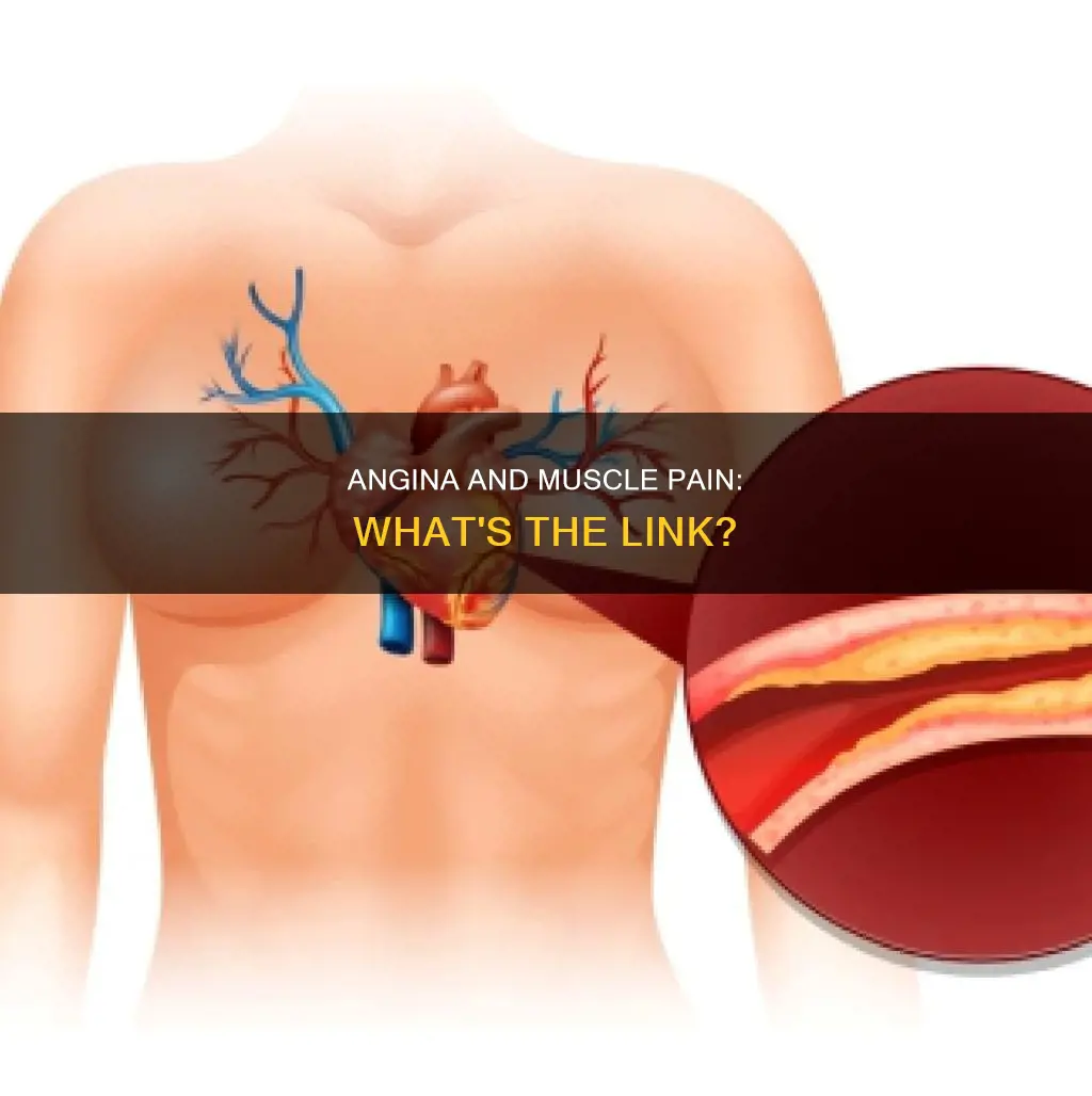 can angina cause muscle pain