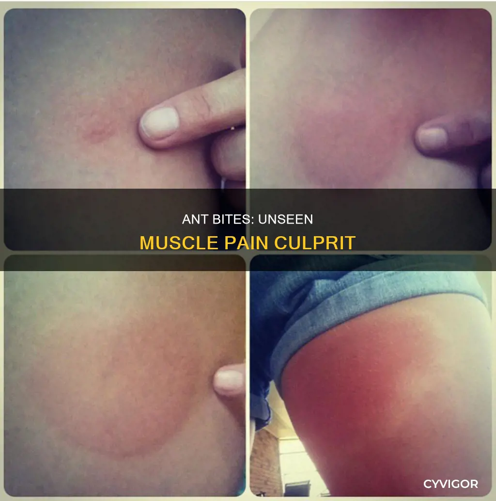 can ant bites cause muscle pain