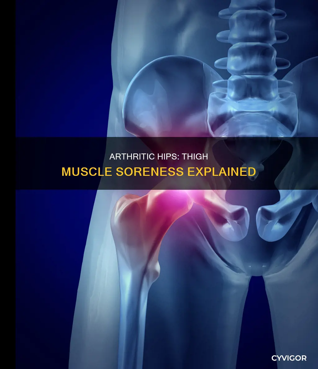 can arthritic hips cause thigh muscle soreness