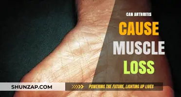 Arthritis and Muscle Loss: What's the Link?
