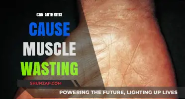 Arthritis and Muscle Wasting: What's the Connection?