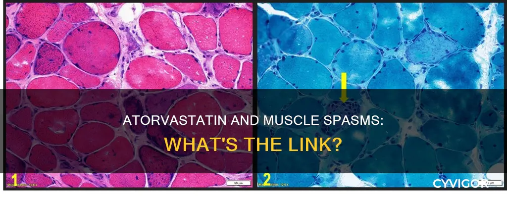 can atorvastatin cause muscle spasm