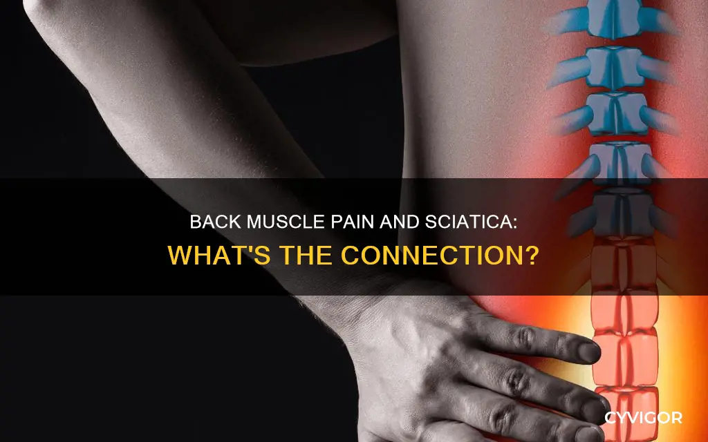 can back muscle pain cause sciatica