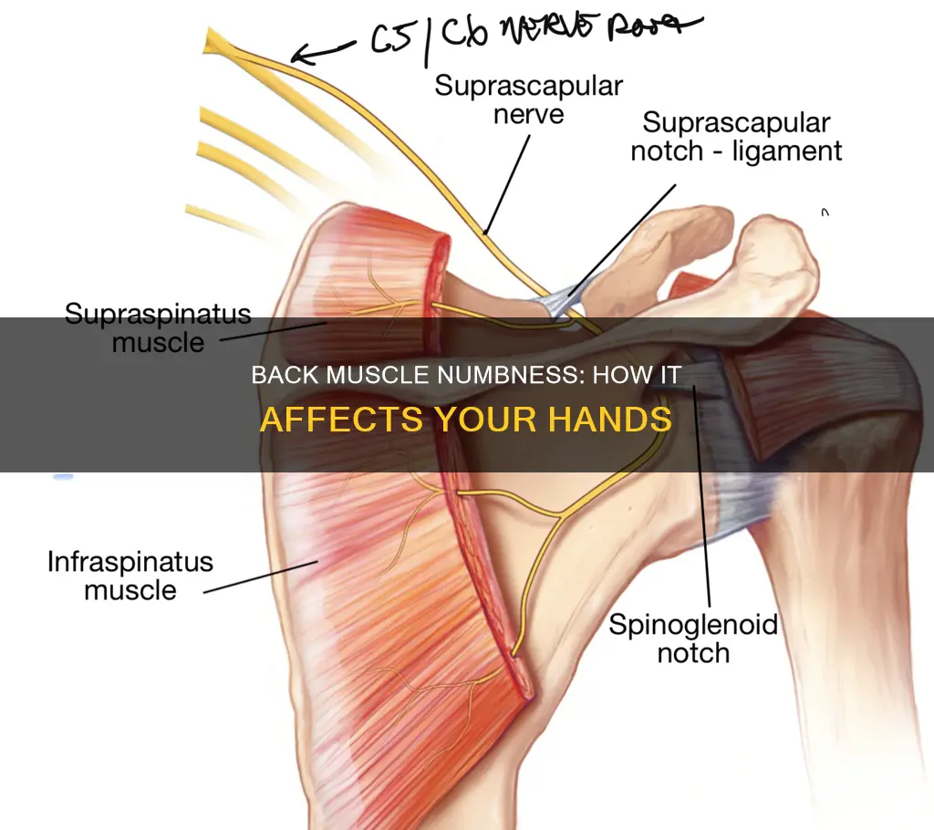 can back muscles cause numbness in hands