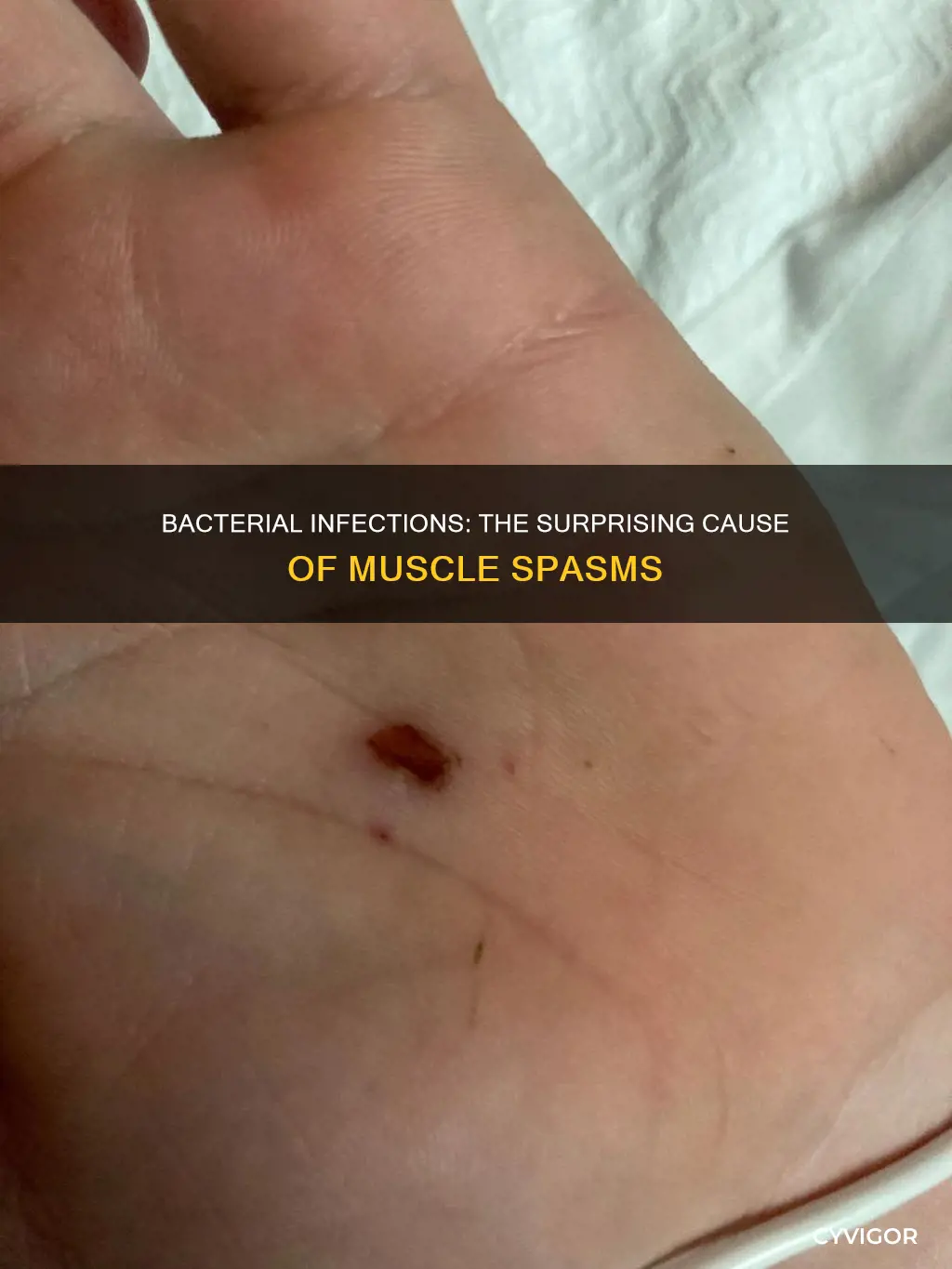 can bacterial infection cause muscle spasms