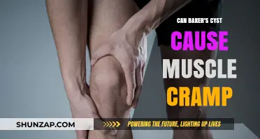 Bakers Cysts and Muscle Cramps: What's the Link?