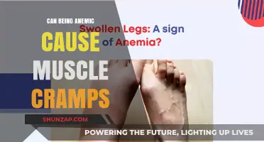 Anemia and Muscle Cramps: What's the Connection?
