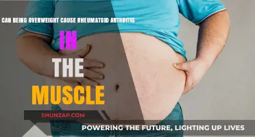 Obesity's Link to Rheumatoid Arthritis and Muscle Pain