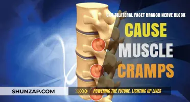 Facet Nerve Block and Muscle Cramps: What's the Link?