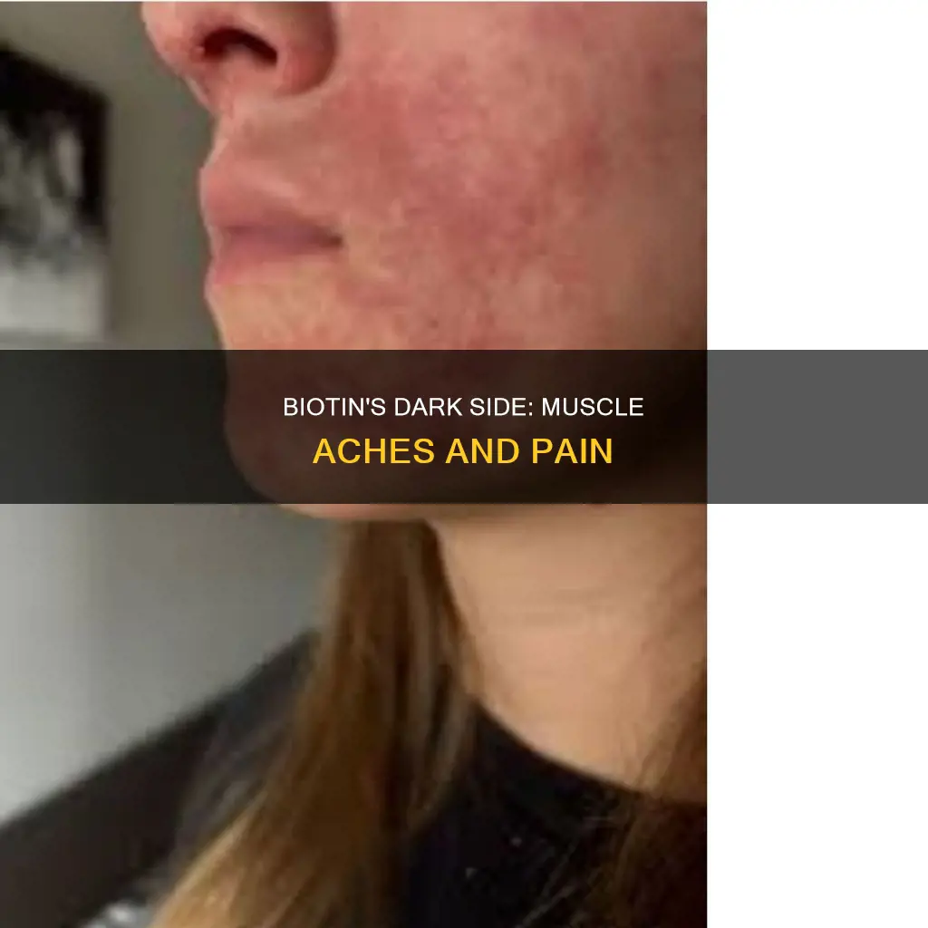 can biotin cause muscle aches