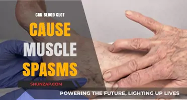 Blood Clots and Muscle Spasms: What's the Connection?