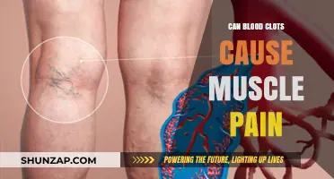 Blood Clots and Muscle Pain: What's the Connection?