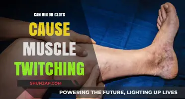 Blood Clots and Muscle Twitching: What's the Link?
