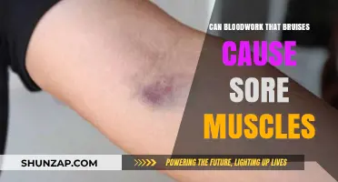 Bruising and Blood Work: Sore Muscle Mystery