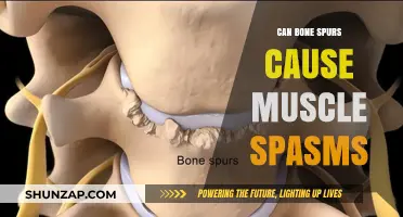 Bone Spurs and Muscle Spasms: Is There a Link?