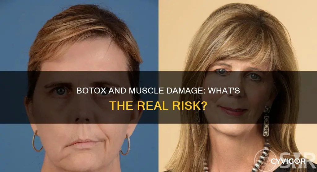 can botox cause permanent muscle damage
